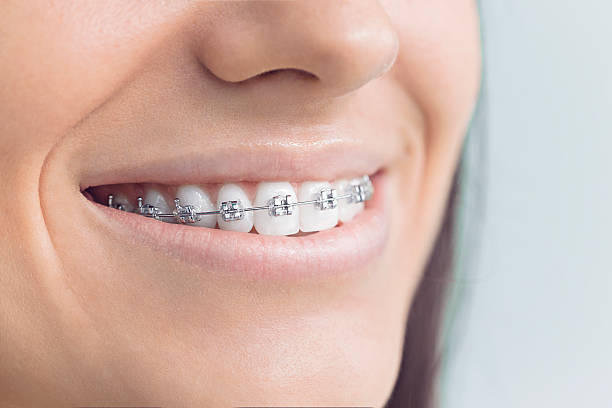 Best Invisalign and Clear Aligners  in Salem, SD